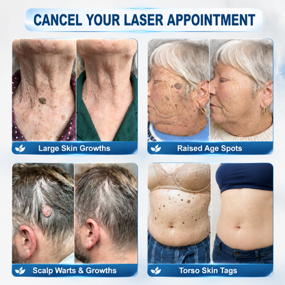 𝐏𝐢𝐜𝐝𝐨® 𝐁𝐨𝐫𝐫𝐚𝐝𝐨𝐫 𝐝𝐞 𝐞𝐭𝐢𝐪𝐮𝐞𝐭𝐚𝐬 𝐲 𝐦𝐚𝐧𝐜𝐡𝐚𝐬 𝐞𝐧 𝟕 𝐝í𝐚𝐬 (𝐀𝐩𝐥𝐢𝐜𝐚𝐝𝐨𝐫 𝐫𝐨𝐥𝐥-𝐨𝐧: 𝐬𝐢𝐧 𝐝𝐨𝐥𝐨𝐫 𝐧𝐢 𝐜𝐢𝐜𝐚𝐭𝐫𝐢𝐜𝐞𝐬)