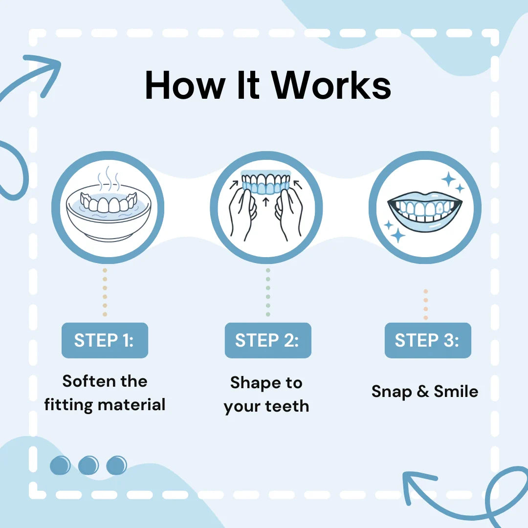 Vaneero™ Clip-on Veneers