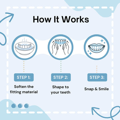 Vaneero™ Clip-on Veneers